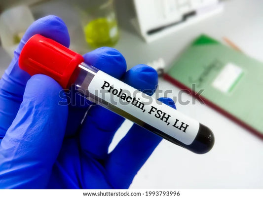 FSH, LH &Prolactin